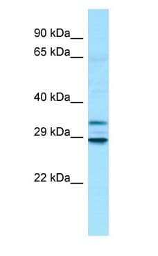 Polyclonal Rabbit anti-Human MTX3 Antibody (N-Terminus, WB)