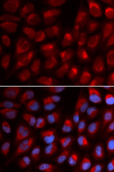 IHC-plus™ Band 4.1 / EPB41 Antibody
