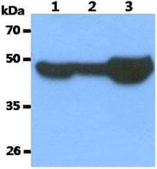 TUBB3 / Tubulin Beta 3 Antibody (clone AT2F5)