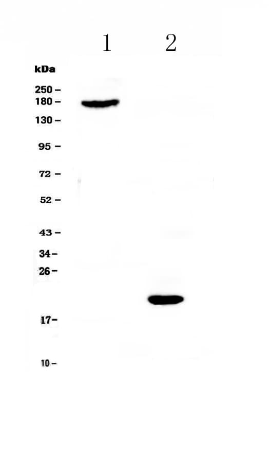 Endostatin Antibody