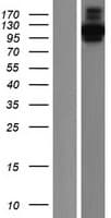 CLIP2 / CYLN2 Protein (Over-Expression Lysate Myc-DDK (Flag))