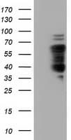 Monoclonal Mouse anti-Human NUMB Antibody (clone OTI2C4, WB)