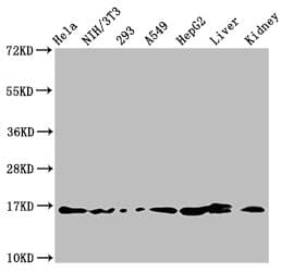 Polyclonal Rabbit anti-Human HIST1H3A Antibody (IHC, WB)