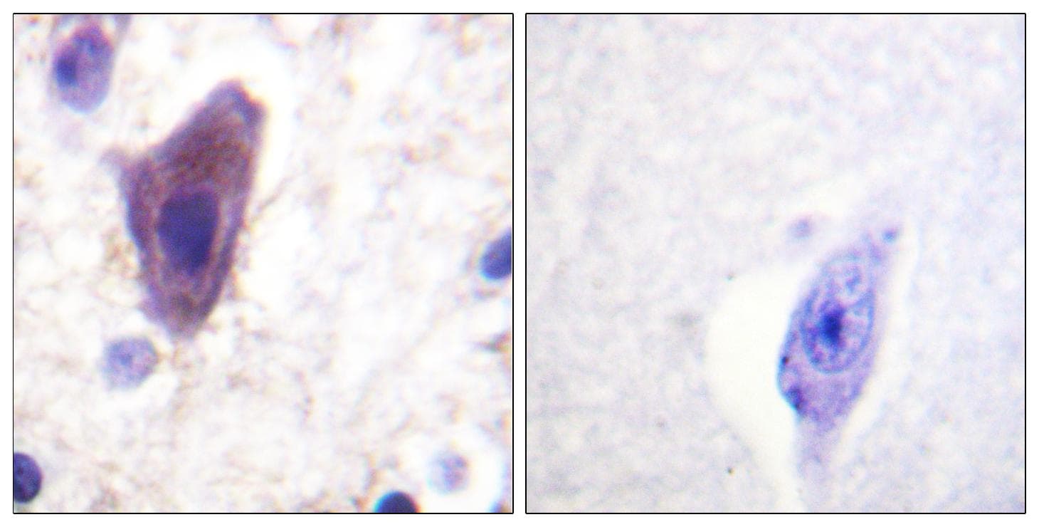CD71 / Transferrin Receptor Antibody (p24)