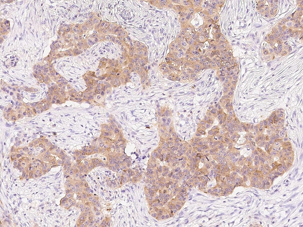 Polyclonal Rabbit anti-Human PHGDH Antibody (Preservative Free, IHC, IF, WB)