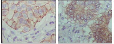 EPHB1 / EPH Receptor B1 Antibody (clone 5F10A4)