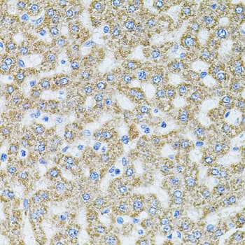 IHC-plus™ MTTP / MTP Antibody