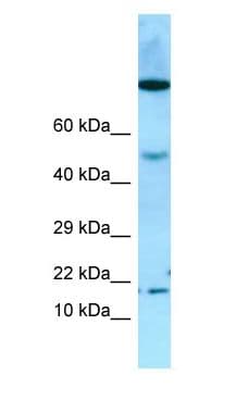 OBP2A Antibody (aa61-110)