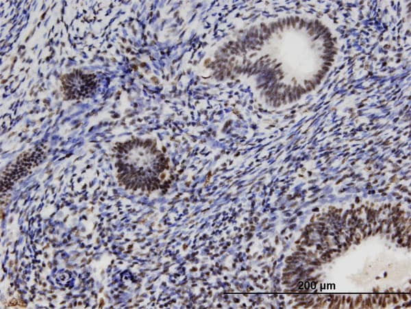 ZFC3H1 Antibody (clone 3A3)