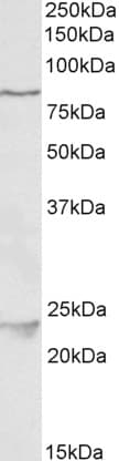 IHC-plus™ Polyclonal Goat anti-Human NAK / TBK1 Antibody (aa514-527, IHC, WB)
