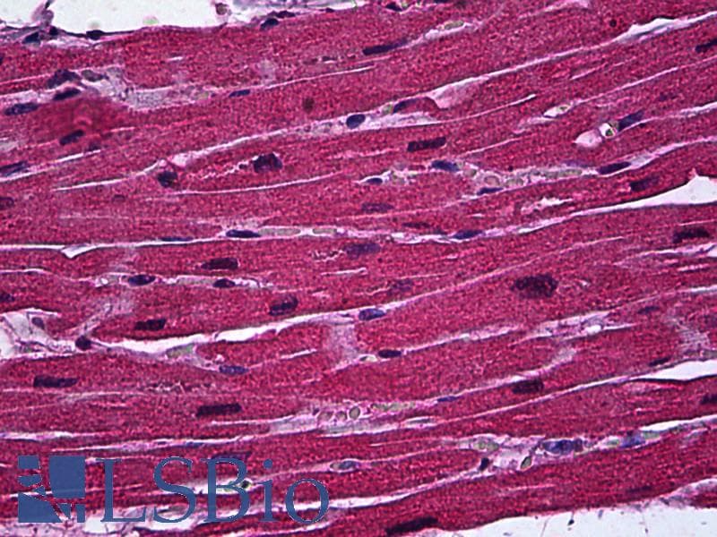 IHC-plus™ Monoclonal Mouse anti-Human BCL11A Antibody (clone 3D9, IHC, WB)