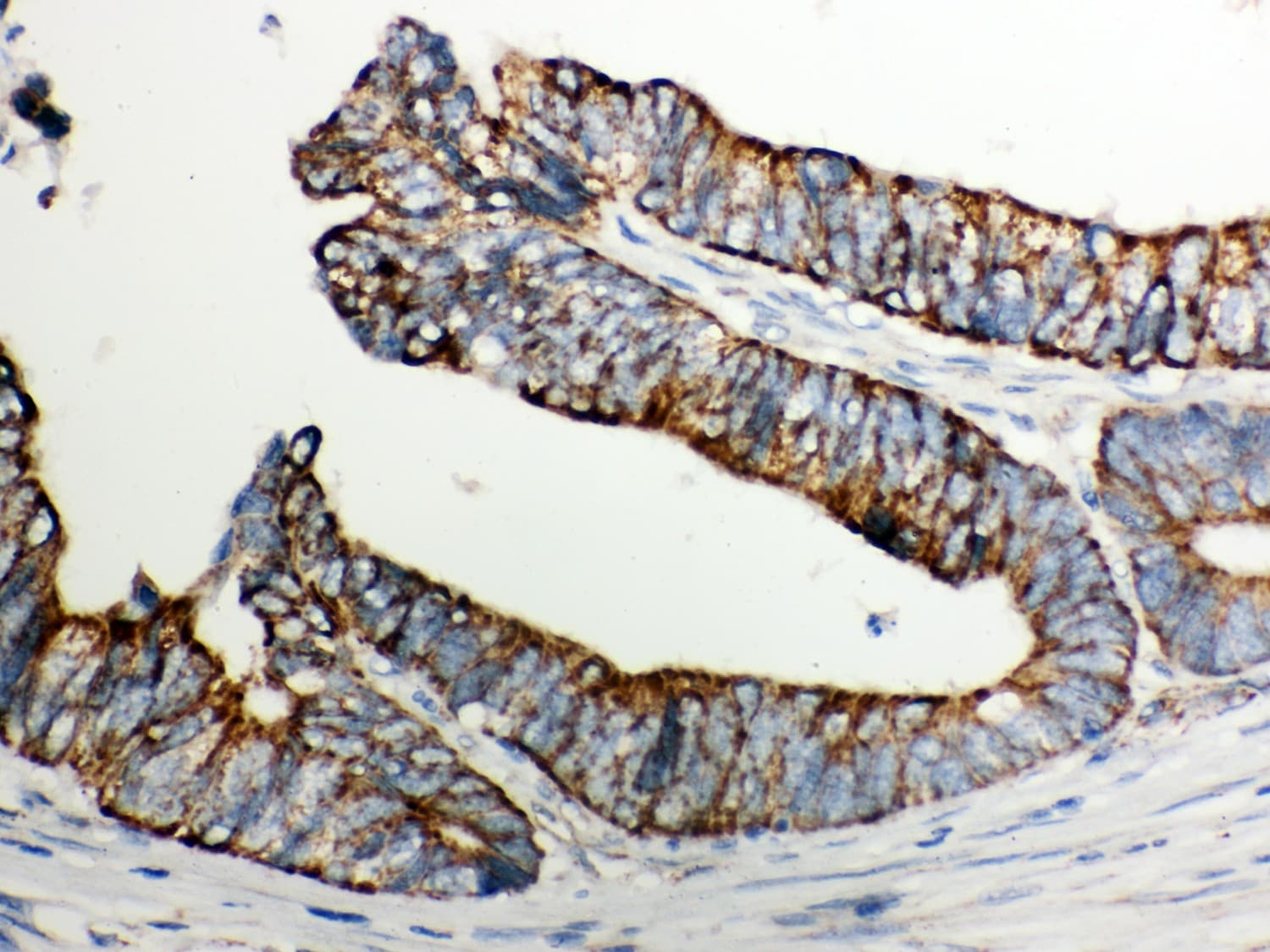 Polyclonal Rabbit anti-Human CYCS / Cytochrome c Antibody (aa2-105, IHC, WB)