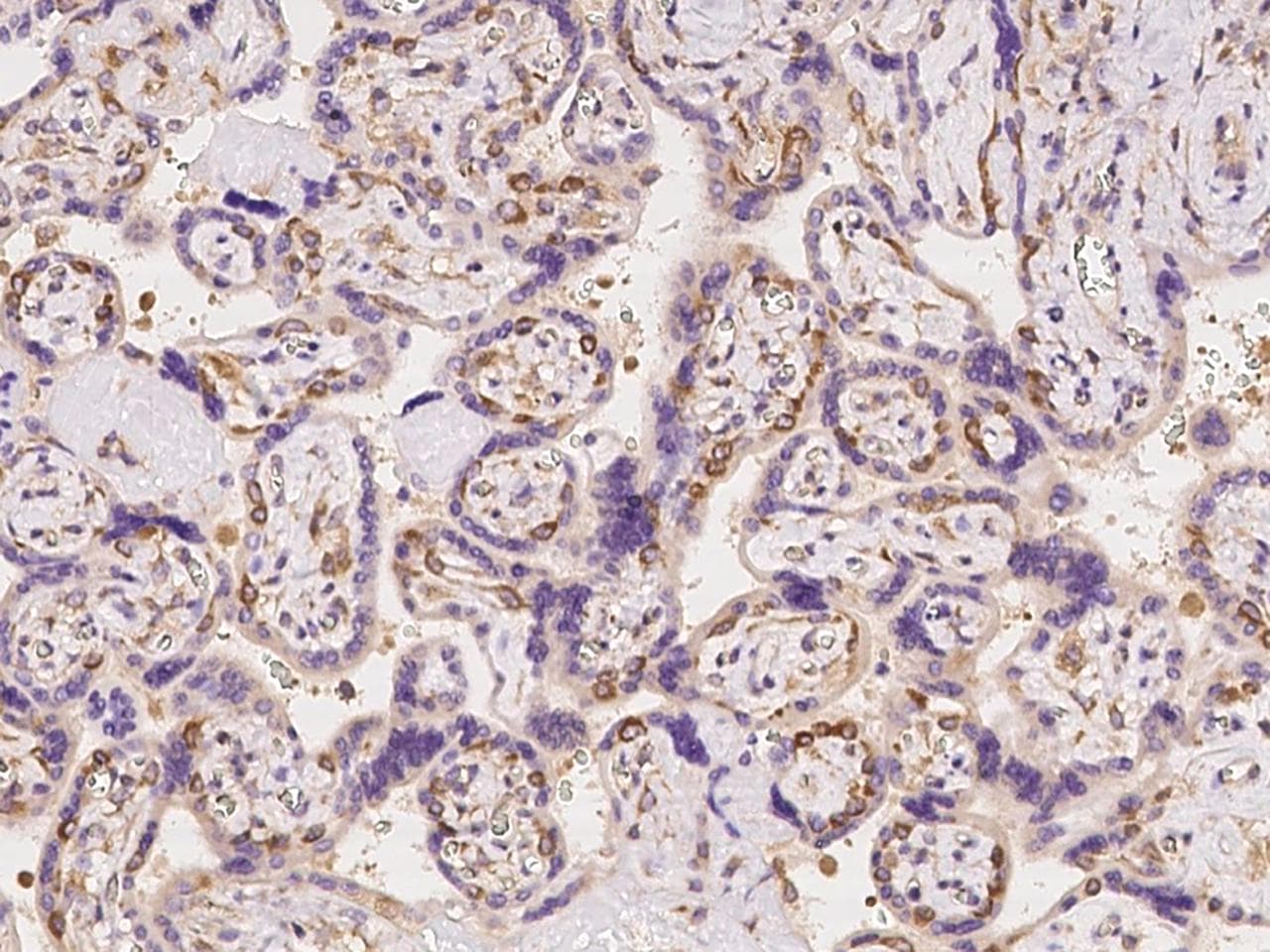 SDCCAG1 / NEMF Antibody