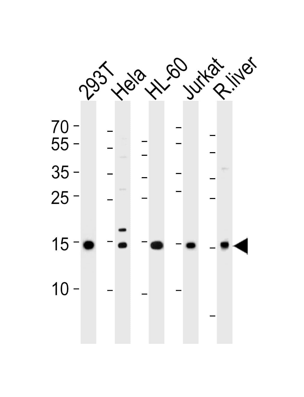 IHC-plus™ SUMO2 + SUMO3 Antibody (aa49-81)