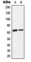 PRKAA1 + PRKAA2 Antibody (phospho-Thr183/Thr172)