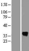 SDS Protein (Over-Expression Lysate Myc-DDK (Flag))