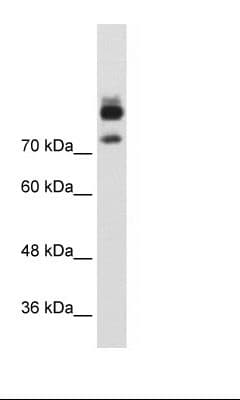 Polyclonal Rabbit anti-Human MTMR1 Antibody (FITC, aa551-600, WB)