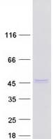 Human INPP5K / SKIP Protein (Recombinant Myc-DDK (Flag))