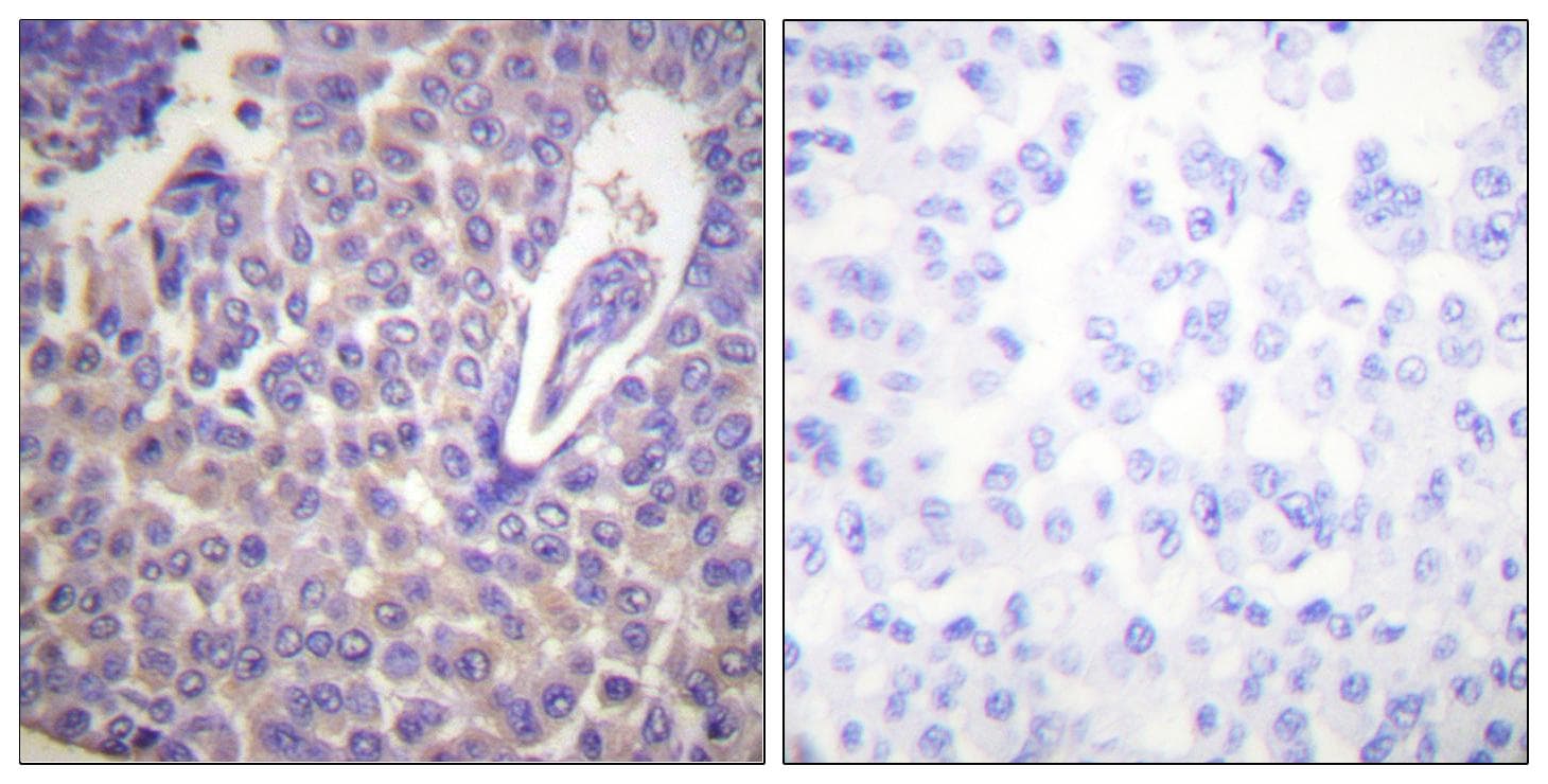 CANX / Calnexin Antibody (phospho-Ser583)