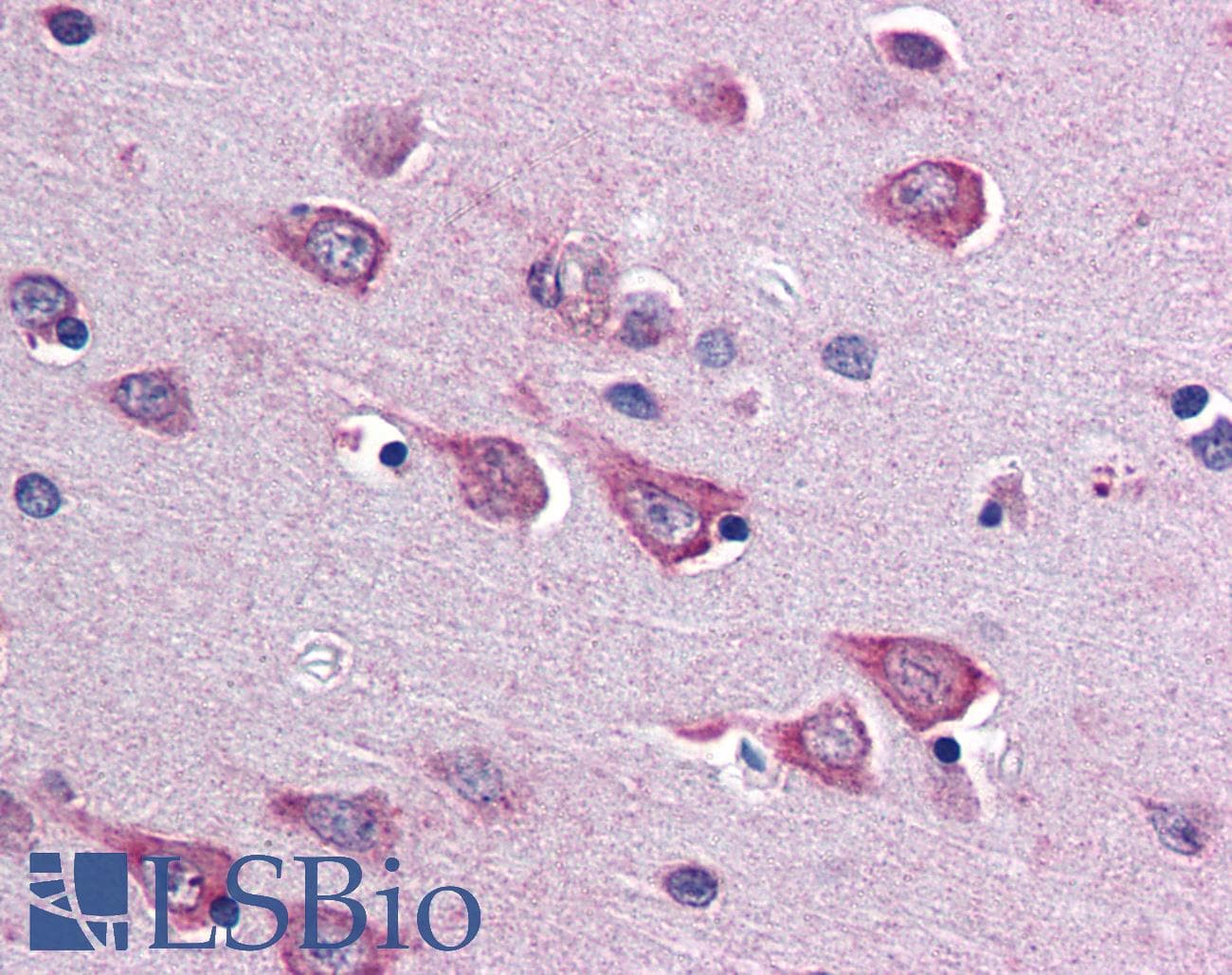 IHC-plus™ SOCS1 Antibody