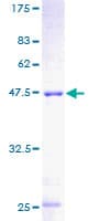 Human MPHOSPH6 Protein (Recombinant GST)