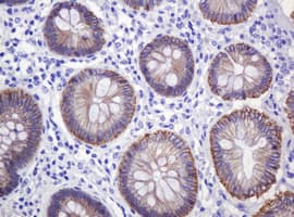 CTNND1 / p120 Catenin Antibody (clone OTI2E8)