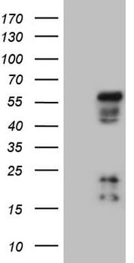NR2E3 / PNR Antibody (clone OTI2H9)