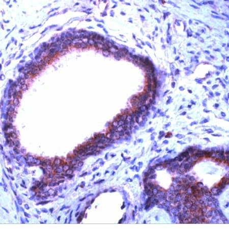 PDGFRB / PDGFR Beta Antibody (C-Terminus)