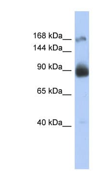 Polyclonal Rabbit anti-Human INSR / Insulin Receptor Antibody (C-Terminus, IHC, WB)