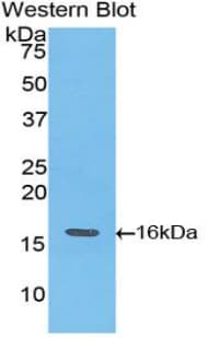 TNNT3 Antibody (aa1-258, Biotin)