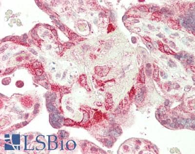 HEY1 Antibody (aa215-264)