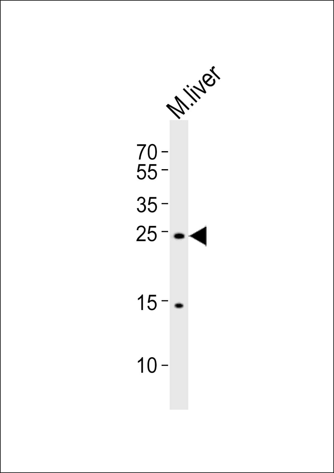 PDCD6 / ALG-2 Antibody (aa103-137)