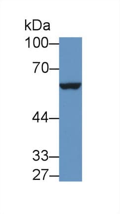IL9R / CD129 Antibody (aa47-257, Cy3)