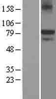 Human ANOS1 / Anosmin Protein (Over-Expression Lysate Myc-DDK (Flag))