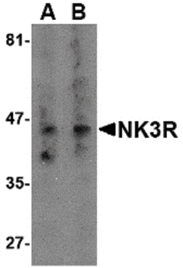 TACR3 / NK3R Antibody