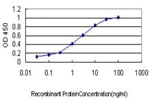 TS / Thymidylate Synthase Antibody (clone 3A1)