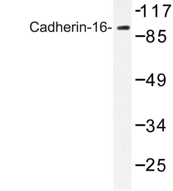 CDH16 / Cadherin 16 Antibody (Met810)