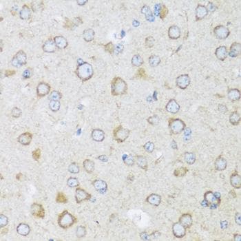 Polyclonal Rabbit anti-Human KIAA1811 / BRSK1 Antibody (IHC)