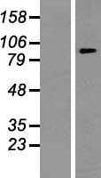 ATP6V0A1 Protein (Over-Expression Lysate Myc-DDK (Flag))