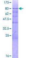 Human ZBTB9 Protein (Recombinant GST)