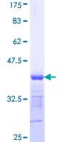 Human MYBPC1 Protein (Recombinant GST, N-terminus)