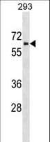 ZNHIT6 / C1orf181 Antibody (aa342-369)
