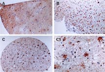 CFLAR / FLIP Antibody (aa75-92)