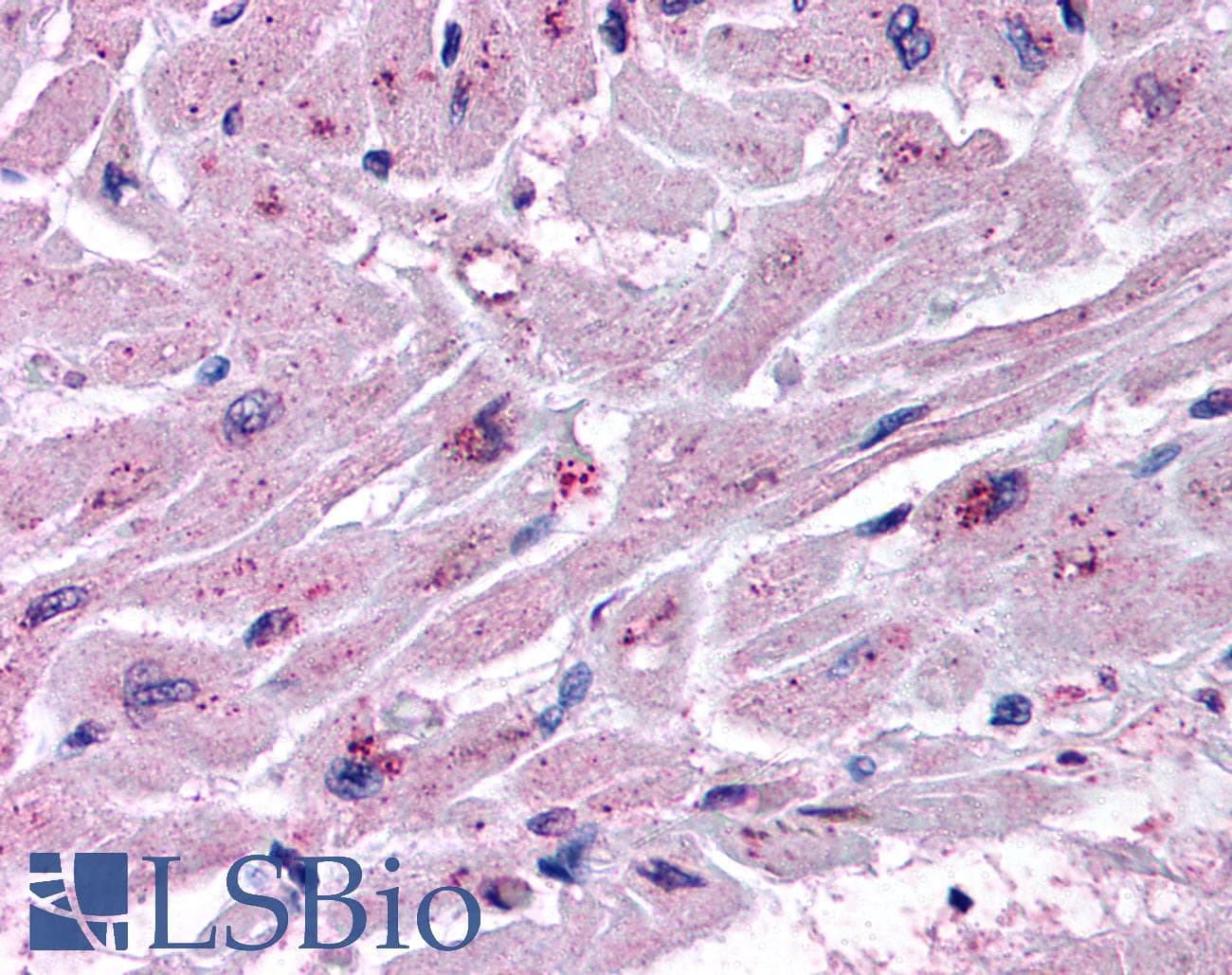 IHC-plus™ CYSLT2 / CYSLTR2 Antibody (Extracellular Domain)