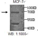 ER Alpha / Estrogen Receptor Antibody