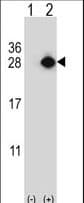 GAS41 Antibody