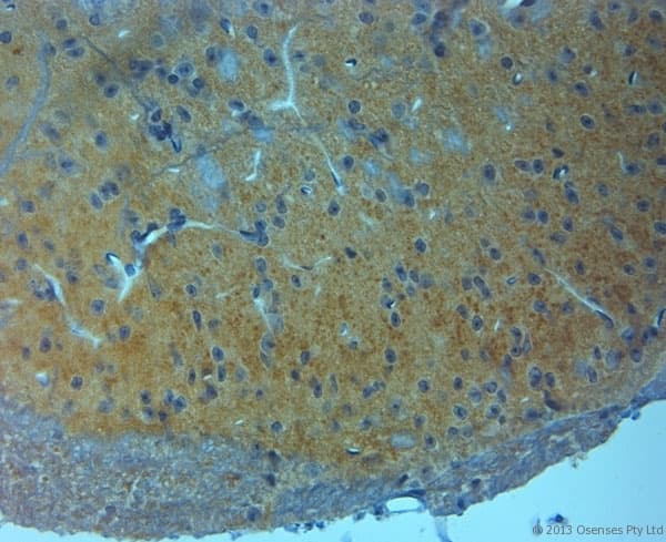 GRIN3A / NR3A Antibody (aa990-1040)