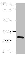 Polyclonal Rabbit anti-Human GS28 / GOSR1 / p28 Antibody (aa1-115, IHC, WB)