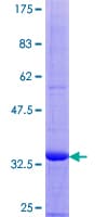 Human SCGB2A1 / Mammaglobin B Protein (Recombinant GST)