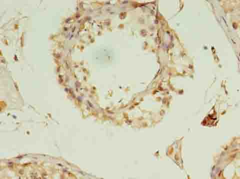 RANBP2 / TRP1 Antibody